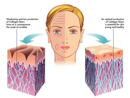 Collagen Replacement Therapy by OrangeCountySurgeons 